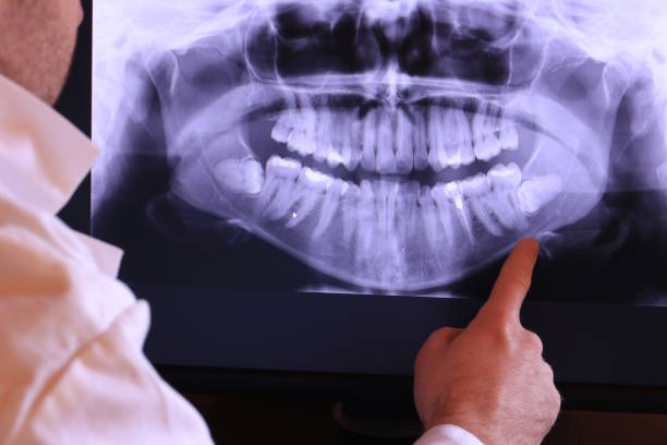 Best Emergency Dentist for Lost Fillings or Crowns in Pickerington, OH